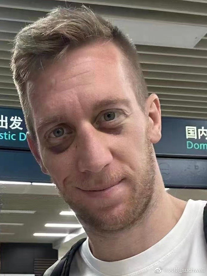 贝里奇眼部红肿引关注