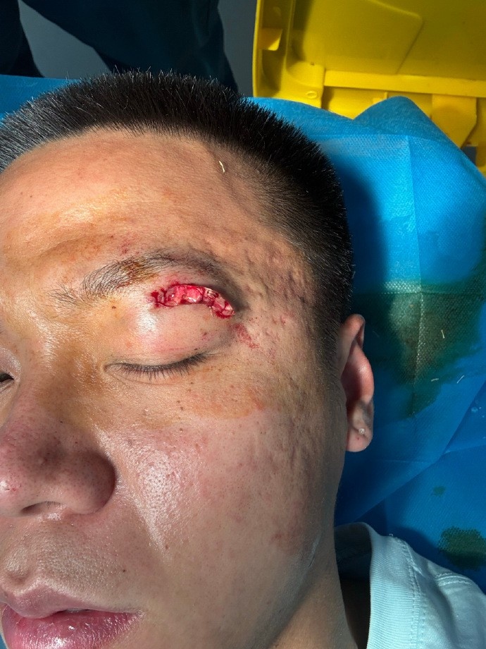  牛梓屹质疑红牌标准